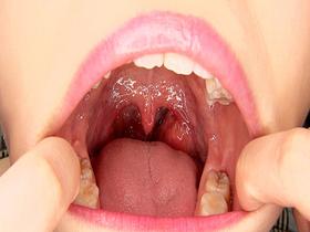 女医の猥褻鼻舐めレズ診察　サンプル画像08